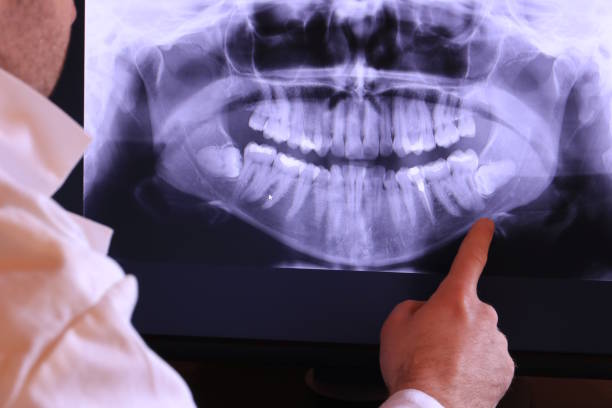 Best Emergency Gum Pain Relief  in Lampasas, TX