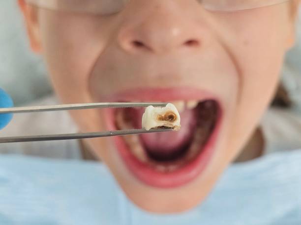 Best Knocked-Out Tooth Emergency  in Lampasas, TX