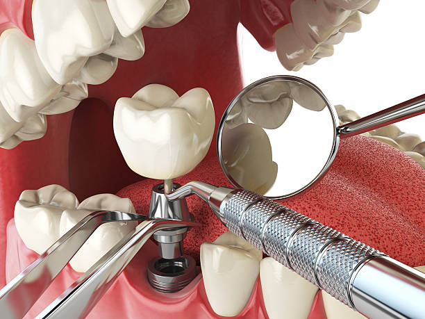 Best Root Canal Emergency Dentist  in Lampasas, TX